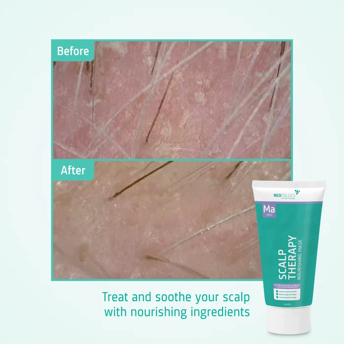 Scalp Therapy Nourishing Mask before after